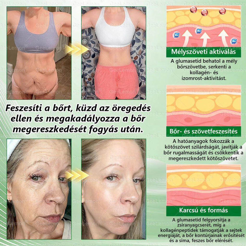 Ajánlott a Semmelweis Kórház által · 👩‍⚕️BENU hivatalos üzlet| 🎁 𝐆𝐞𝑒𝐿𝑒𝐦𝐨𝐧® Glumasetide 8 az 1-ben Karcsú és Egészséges Nano Mikrotűs Tapasz