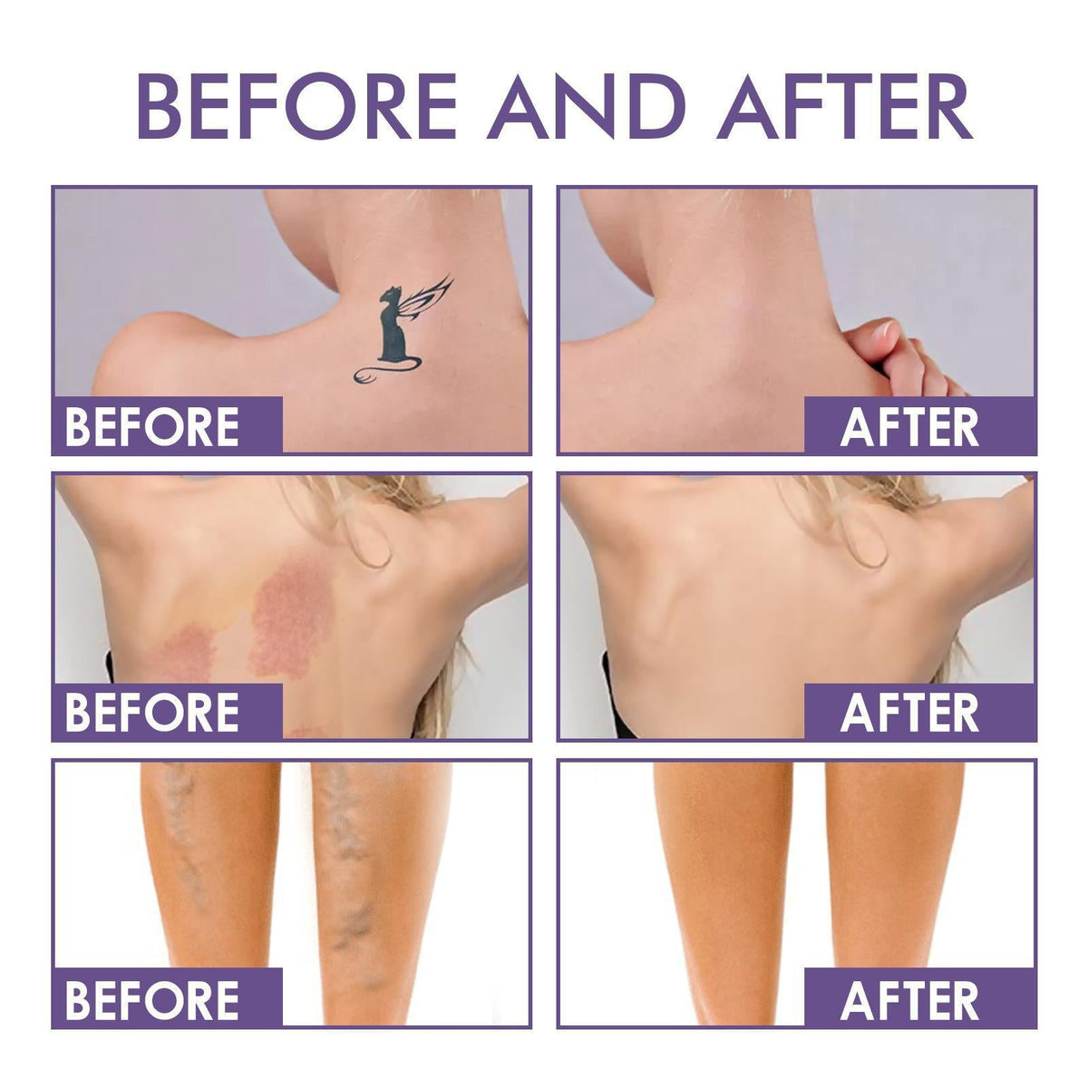 💜Utolsó nap – vegyél 1-et, kapsz 1-et ingyen!💜✨Body Perfector – vízálló, könnyű és hibátlan testfesték