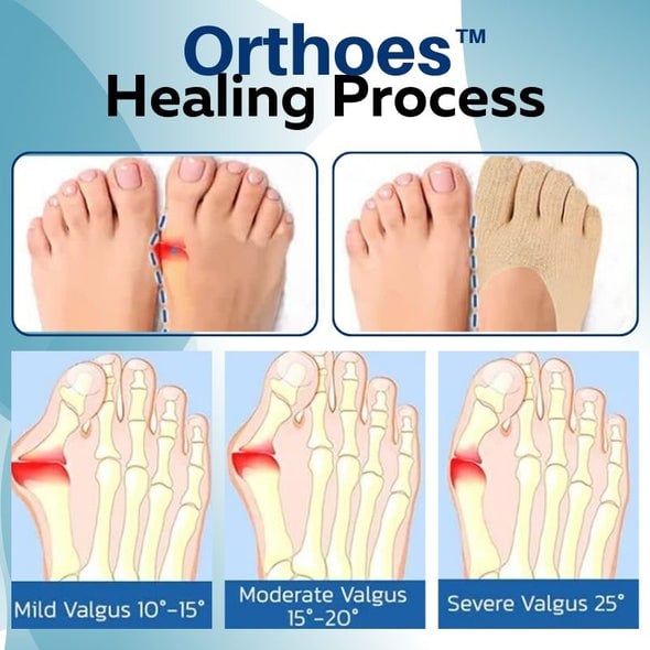 Ортопедични чорапи Orthoes™