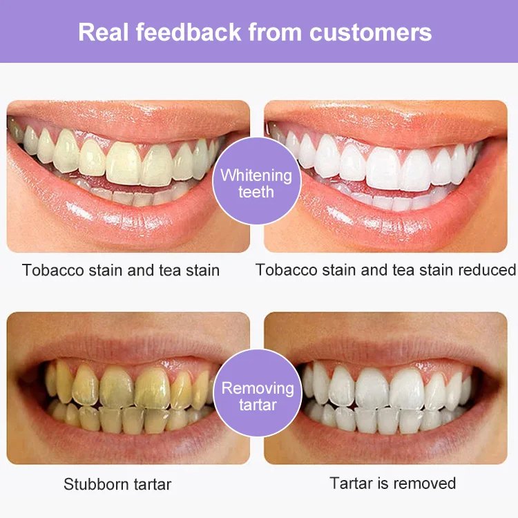 Ефективно избелваща паста за зъби