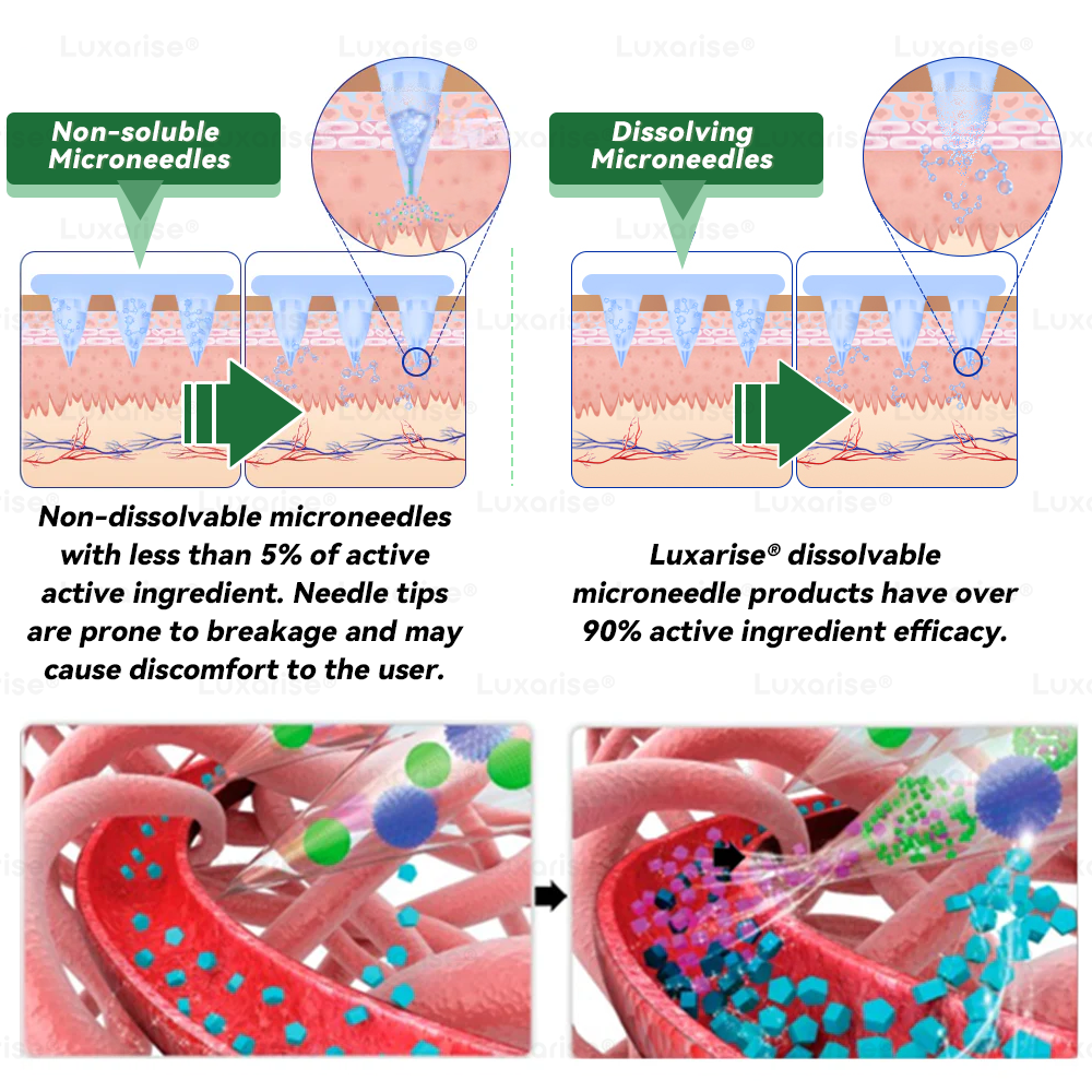 Официален магазин | Luxarise® Моринга и Берберин 10 в 1 пластир с наномигли 📦 (веднъж дневно, видими промени след 7 дни) Проблеми със ставите Затлъстяване, диабет, сънна апнея и