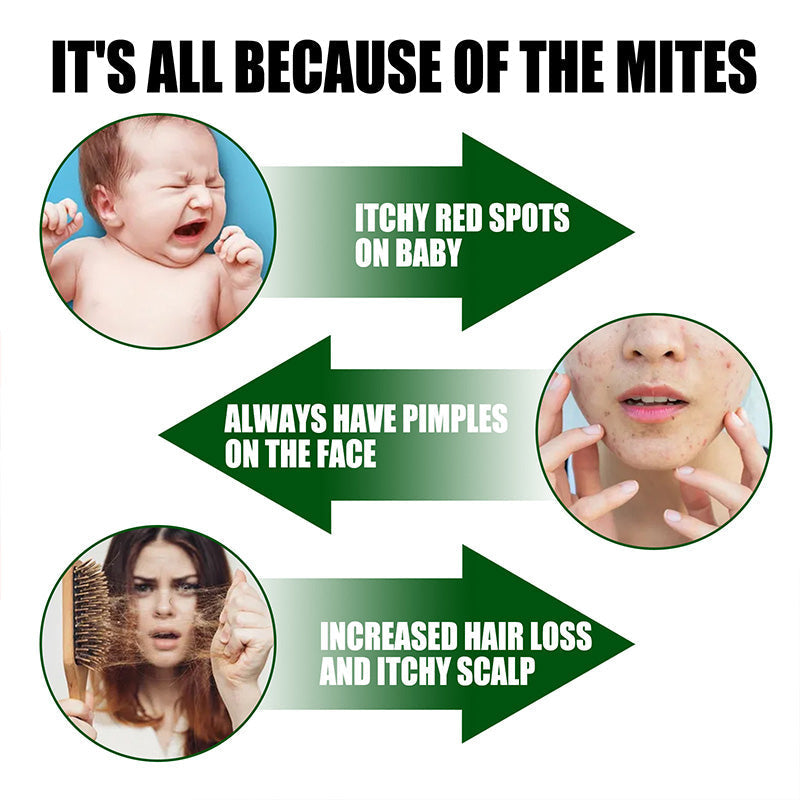 ⚡Ограничена разпродажба Купете 2, вземете 1 безплатно⚡-🧑‍⚕️Силен спрей за премахване на акари