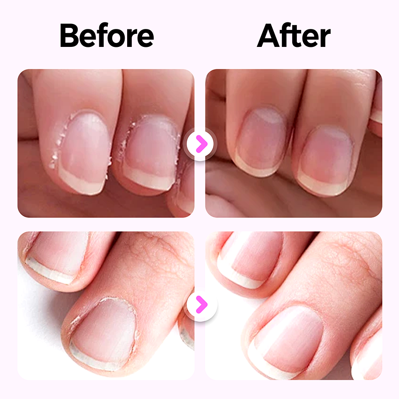 💜Купете 1, вземете 1 безплатно💜2025 Нов и подобрен 3-в-1 писалка за нокти💅